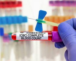 Cost of Full Blood Test in South Africa