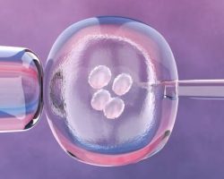 Cost of IVF in Nigeria and Recommended IVF Centers 2022/2023